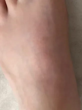 OnlyFans cuenta anniefeet75 avatar 1