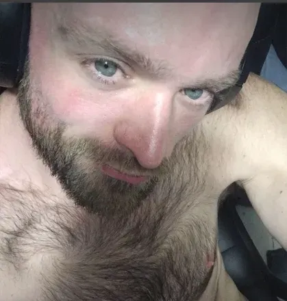 OnlyFans cuenta psychoskitzo avatar 1