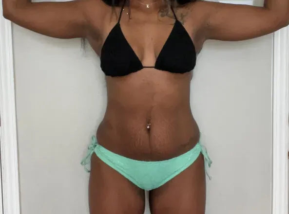 OnlyFans cuenta u315884933 avatar 1