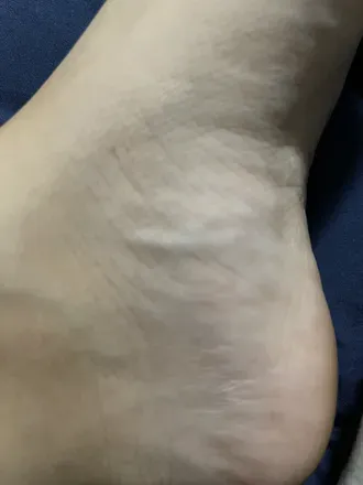 OnlyFans account  us.feets avatar 1