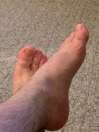 OnlyFans cuenta squatchyfeet avatar 1