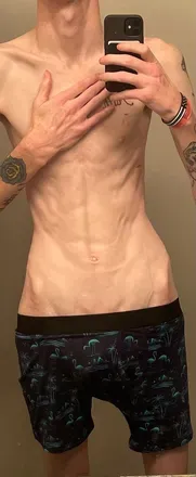 OnlyFans cuenta lazylungs318 avatar 1