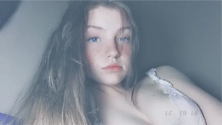 OnlyFans cuenta girlwithscars avatar 1
