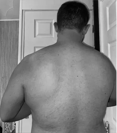 OnlyFans cuenta chunkymanaxel avatar 1
