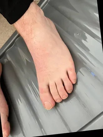 OnlyFans cuenta footpichunk avatar 1