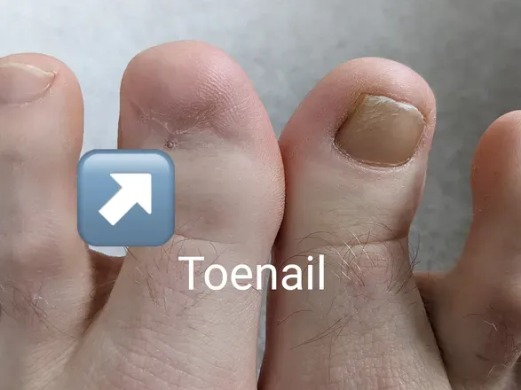 OnlyFans cuenta toenailguy header 2