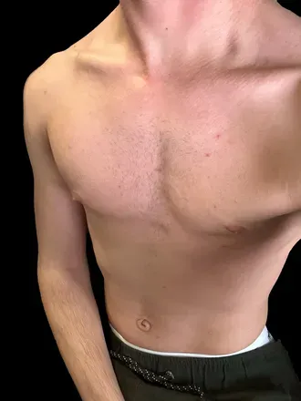 OnlyFans cuenta uncutmushroom avatar 1
