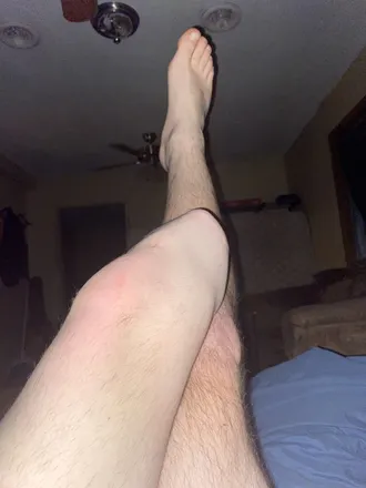 OnlyFans cuenta amputeeforlife header 2