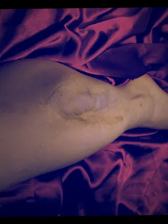 OnlyFans cuenta sexywiththescars header 2