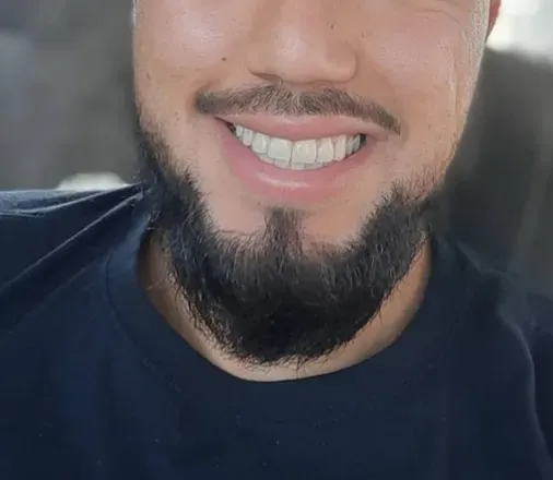 OnlyFans cuenta ivu_23 avatar 1