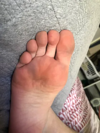 OnlyFans cuenta raynaudsfoot header 2