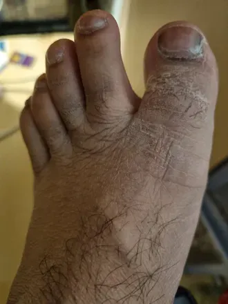 OnlyFans account  mruglyfeetalpa avatar 1
