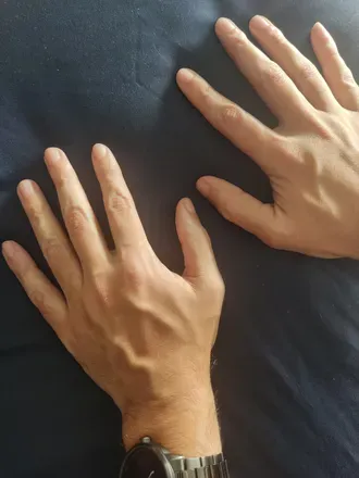 OnlyFans cuenta manhands_med avatar 1