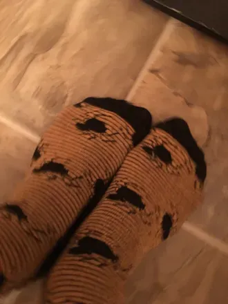 OnlyFans cuenta catchfeet avatar 1