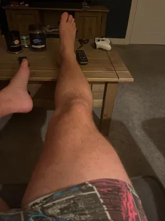 OnlyFans cuenta legsbennedict avatar 1