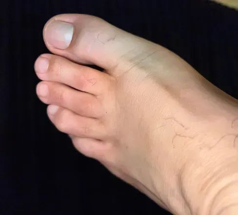 OnlyFans cuenta melbfeet avatar 1