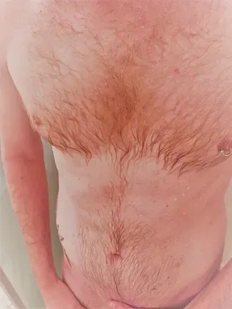 OnlyFans cuenta otrpupbjorn avatar 1