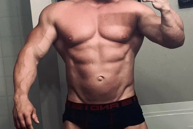 OnlyFans cuenta radekstrose header 2