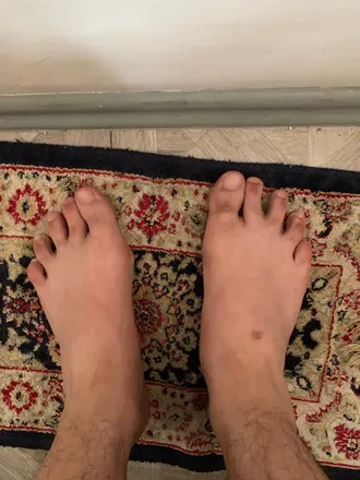 OnlyFans cuenta my_ugly_feet avatar 1