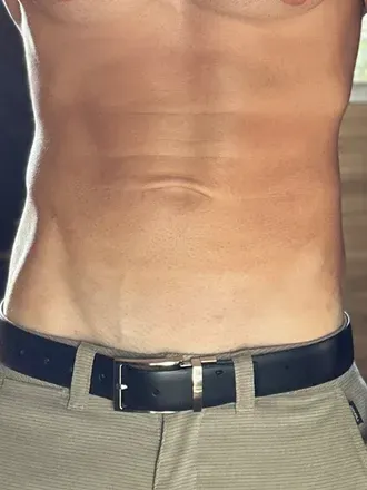 OnlyFans cuenta stoneymanking avatar 1
