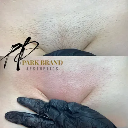 OnlyFans cuenta parkbrand avatar 1