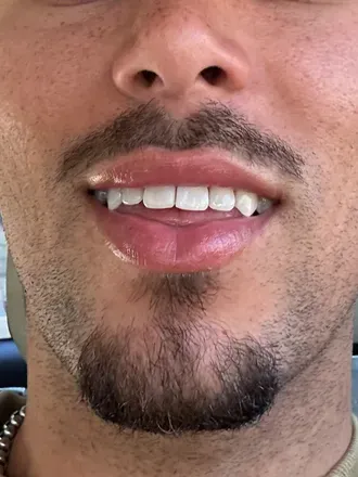 OnlyFans account  dallasdoesit avatar 1