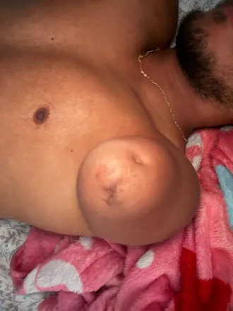 OnlyFans de menamputee
