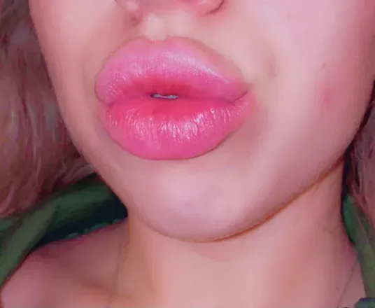 OnlyFans account  massivelips avatar 1