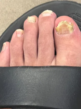 OnlyFans cuenta hobbitfeet84 header 2