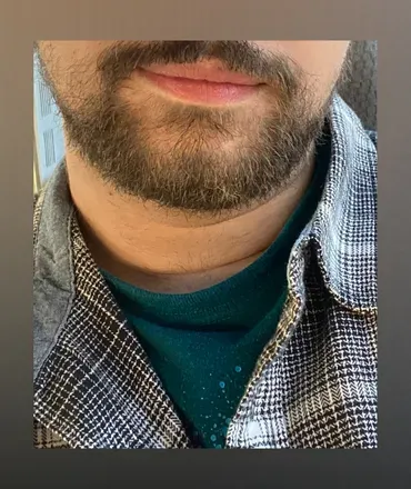 OnlyFans account  umbfans avatar 1