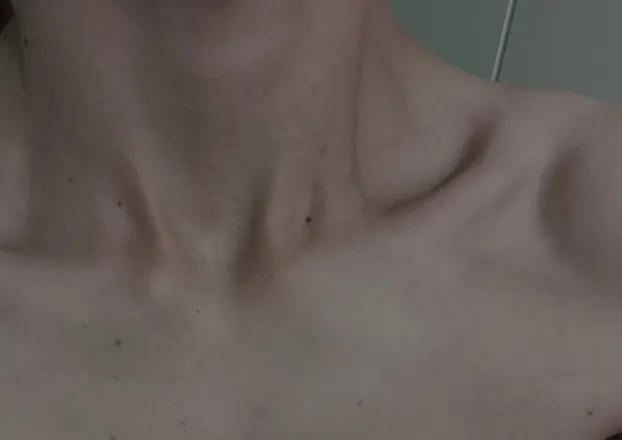 OnlyFans cuenta skinnnbonesss header 2