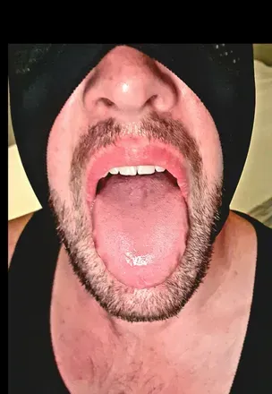 OnlyFans account  losenmascaradosxxx avatar 1
