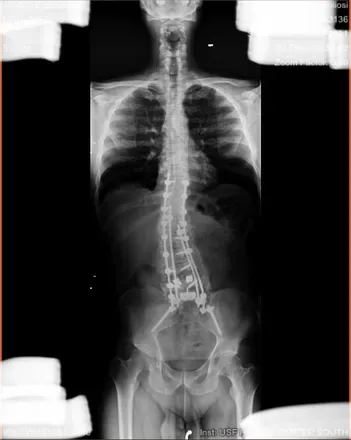 OnlyFans cuenta metal_spine header 2