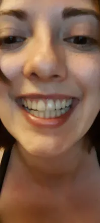 OnlyFans account  onlyteeth header 2