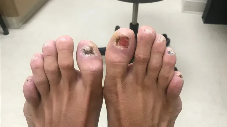 OnlyFans cuenta goddess_without_toenails header 2