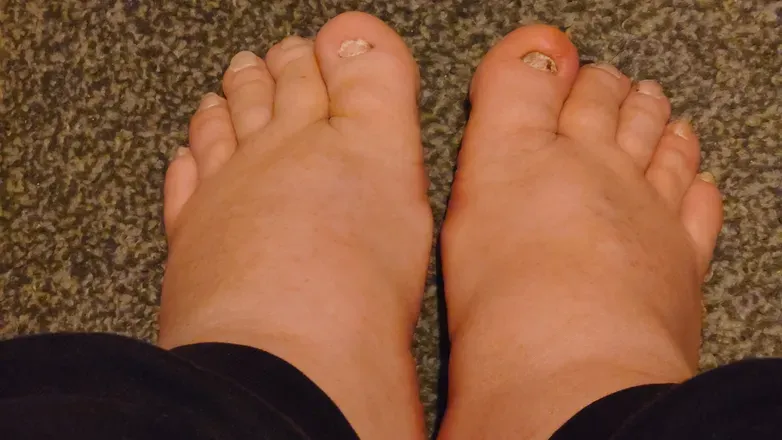 OnlyFans cuenta fatfeet.22 avatar 1