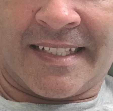 OnlyFans cuenta fonsi2023 avatar 1