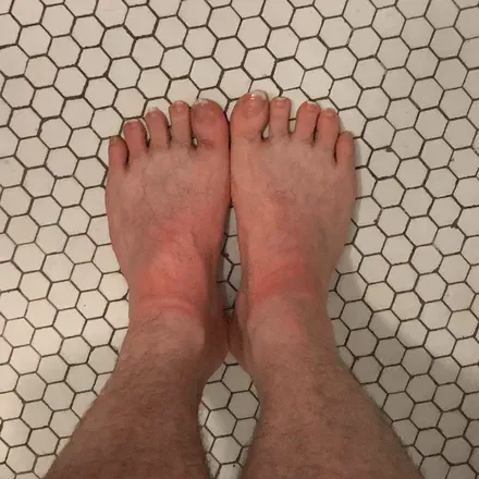 OnlyFans account  feetchicago avatar 1