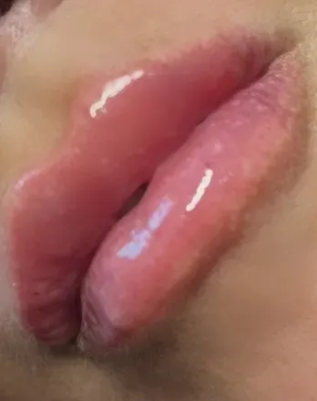 OnlyFans cuenta u170885704 avatar 1