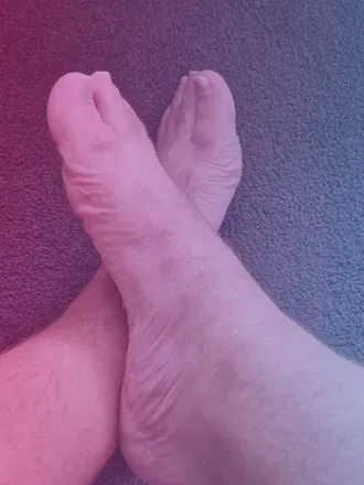 OnlyFans cuenta toesrfun87 avatar 1