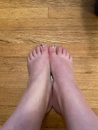 OnlyFans cuenta diabeticfeet header 2
