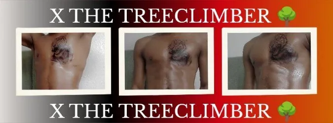 OnlyFans cuenta treeclimberxxxx header 2