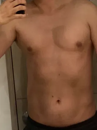 OnlyFans cuenta medicenalejocor avatar 1