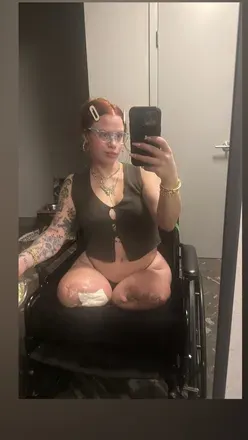 OnlyFans cuenta amputeedoll avatar 1