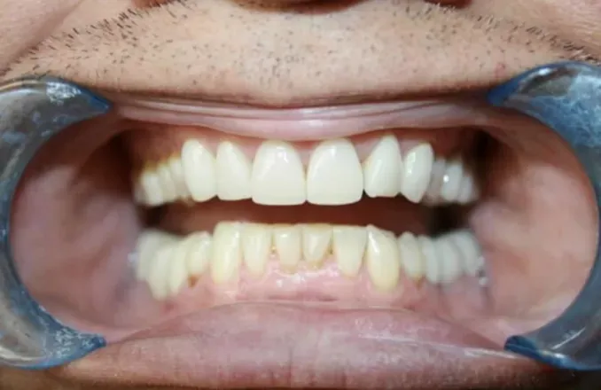 OnlyFans cuenta toothfetish_doc avatar 1