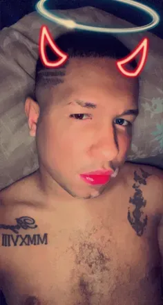 OnlyFans cuenta vitiligo1 avatar 1