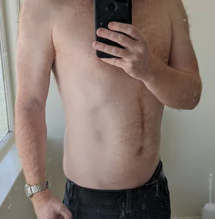 OnlyFans de foobar