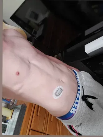 OnlyFans cuenta u8052047 avatar 1