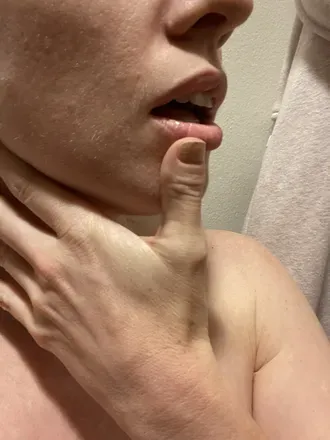 OnlyFans cuenta mstoethumbs avatar 1