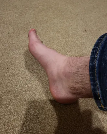 OnlyFans cuenta dadbod-feet header 2
